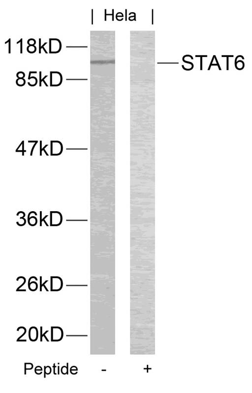 STAT6(Ab-645) Antibody