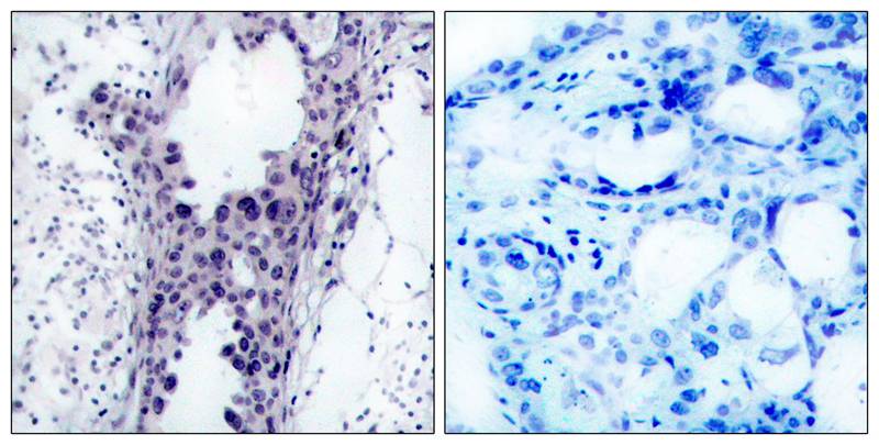 PTEN(Ab-380/382/383) Antibody