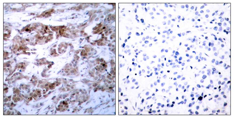 BCL-2(Ab-70) Antibody