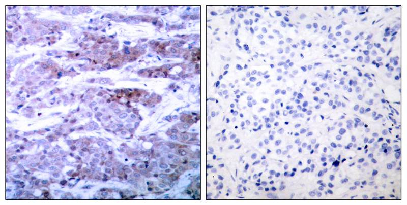 BAD(Ab-112) Antibody