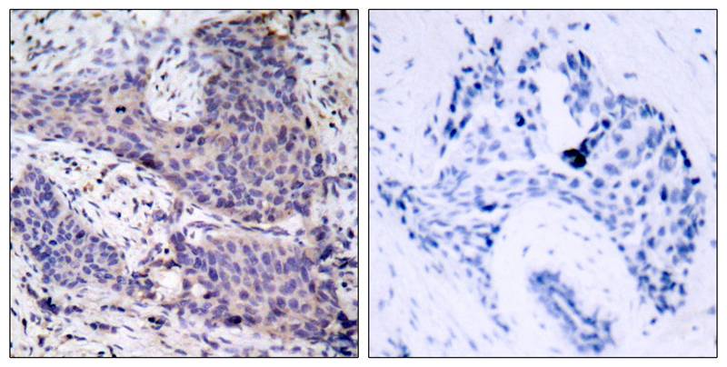 BAD(Ab-136) Antibody