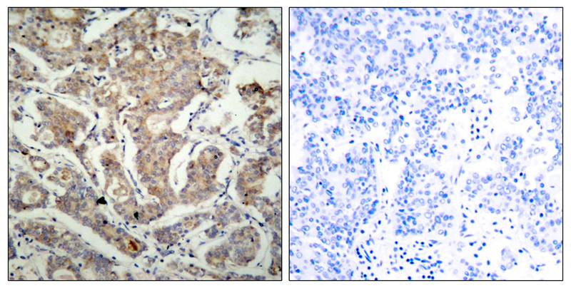 BAD(Ab-155) Antibody