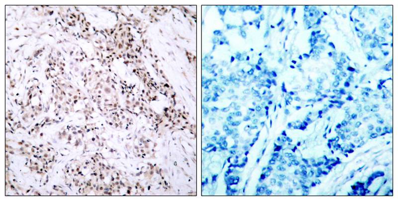 Estrogen Receptor-a Antibody