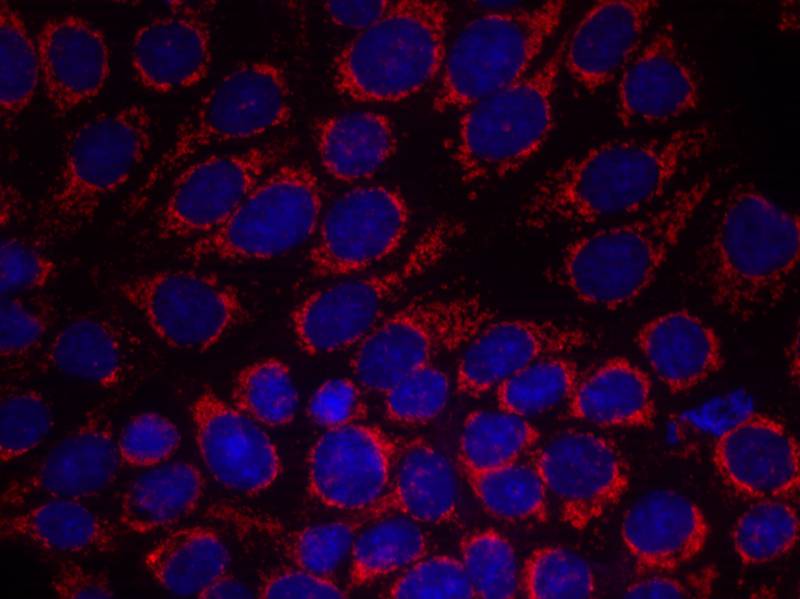 HER2(Ab-1248) Antibody