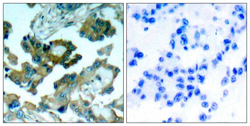 FAK(Ab-861) Antibody