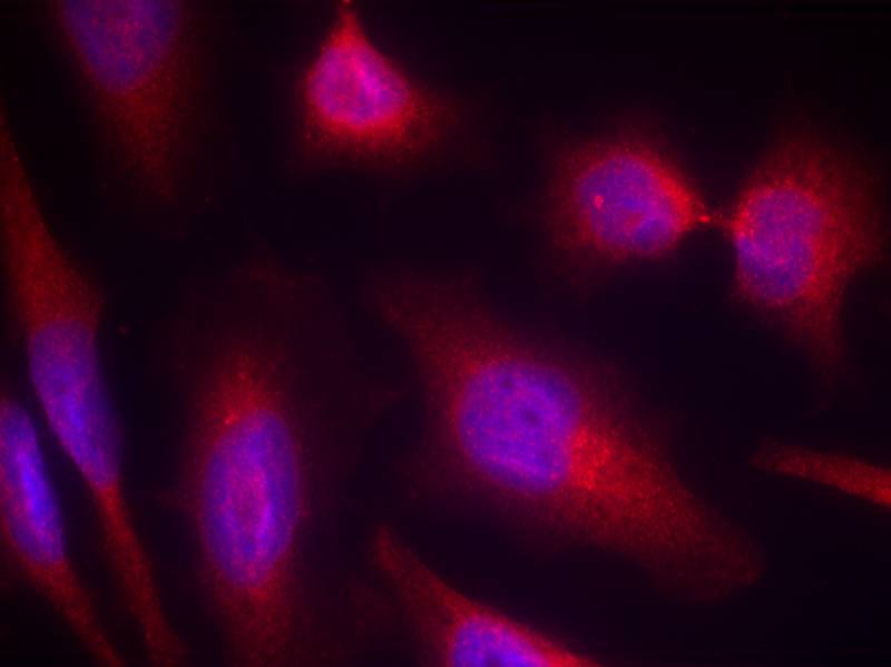 Tau(Ab-214) Antibody - SAB | Signalway Antibody