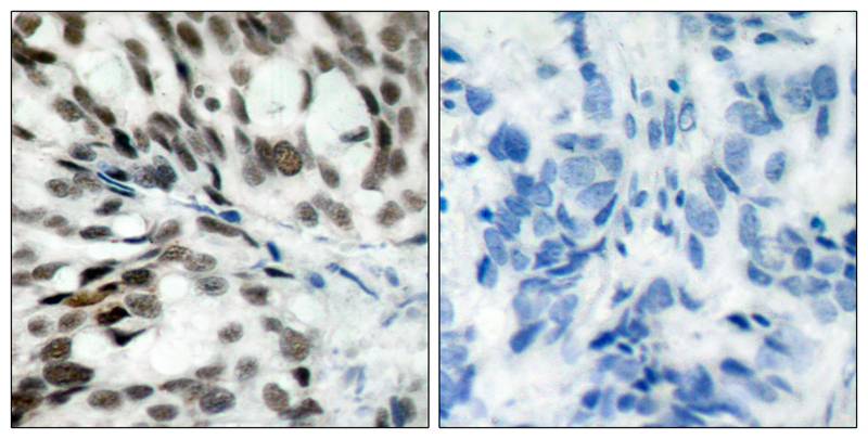 Rb(Ab-780) Antibody