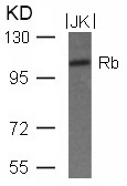 Rb(Ab-780) Antibody