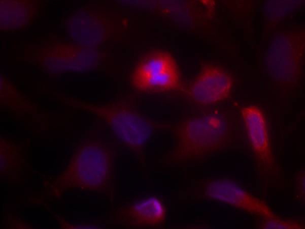 ASK1(Ab-966) Antibody