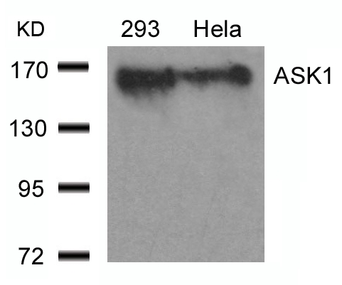 ASK1(Ab-966) Antibody