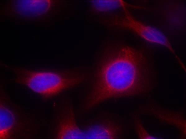 MEK1/MEK2(Ab-217/221) Antibody