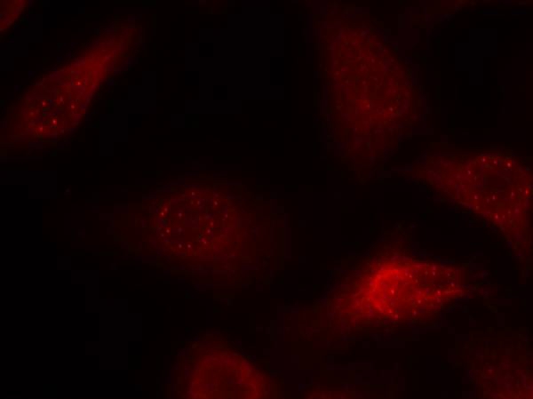 APP(Ab-668) Antibody