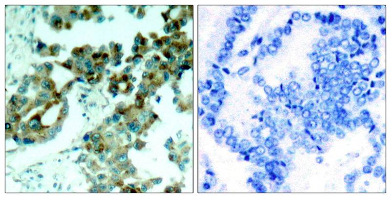 S6 Ribosomal Protein(Ab-235) Antibody