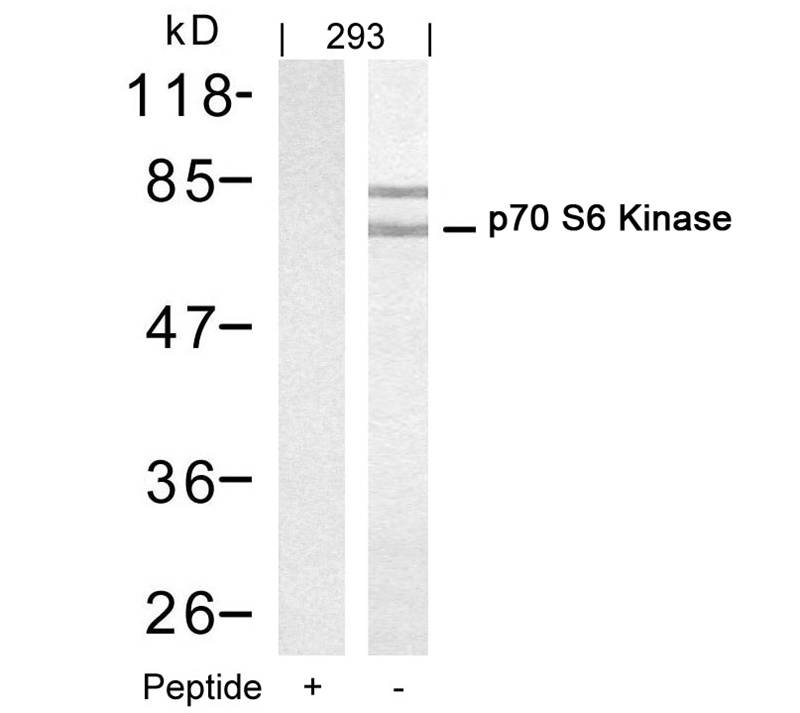 p70 S6 Kinase(Ab-421) Antibody