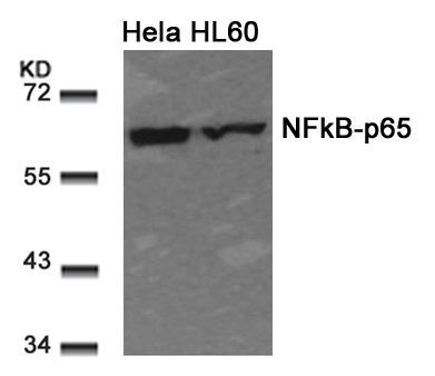 NFkB-p65(Ab-311) Antibody