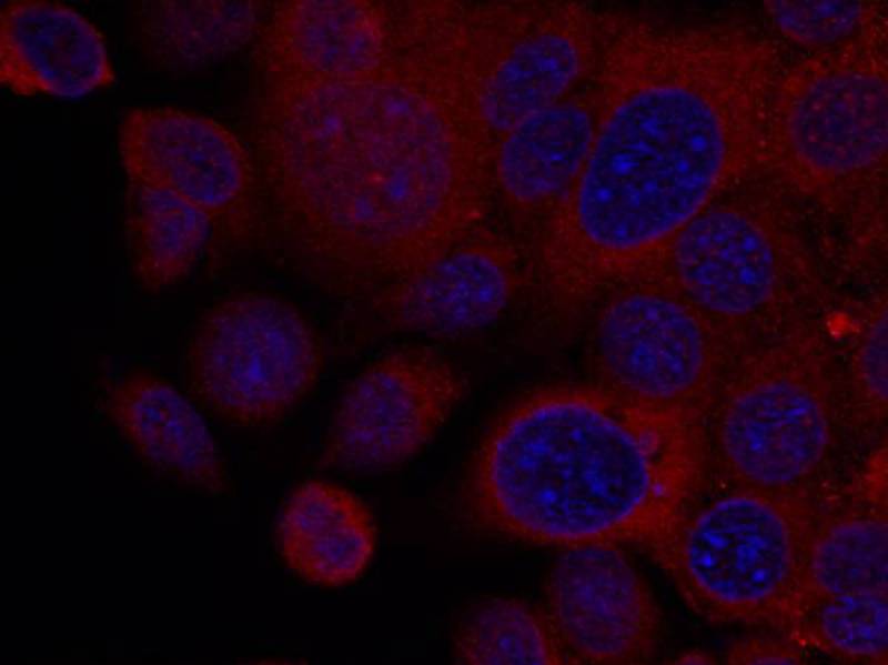 p70 S6 Kinase(Ab-411) Antibody