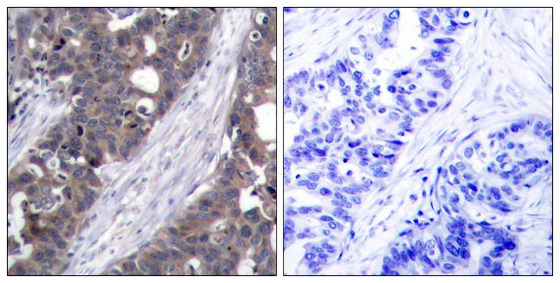 p70 S6 Kinase(Ab-411) Antibody