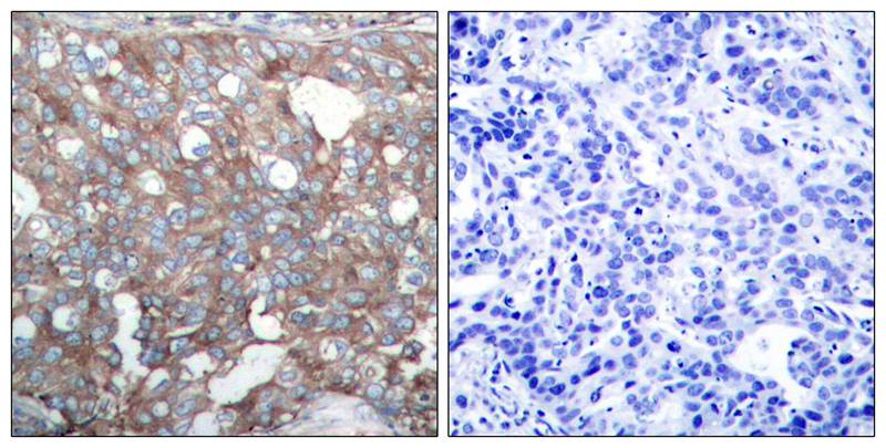 Cortactin(Ab-421) Antibody