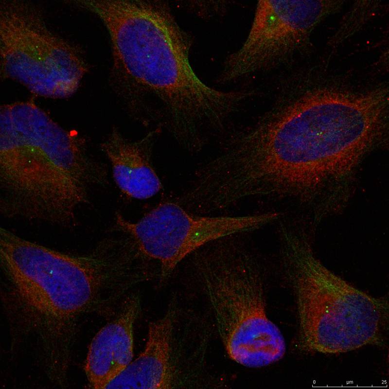 NFkB-p100(Ab-872) Antibody