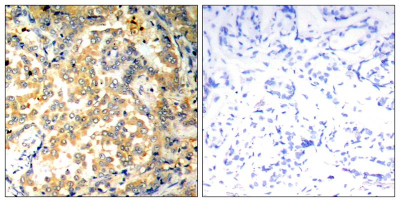 NFkB-p100(Ab-872) Antibody