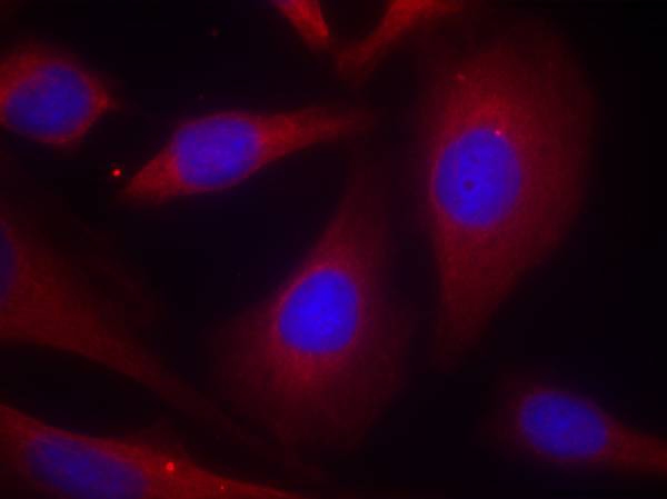 NFkB-p105(Ab-927) Antibody