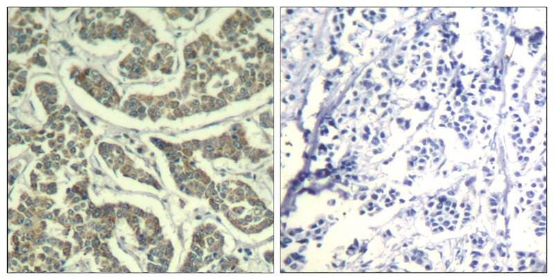 ATR(Ab-428) Antibody