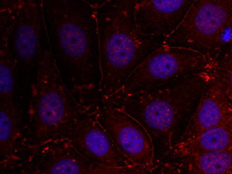 Her3/ErbB3(Ab-1289) Antibody