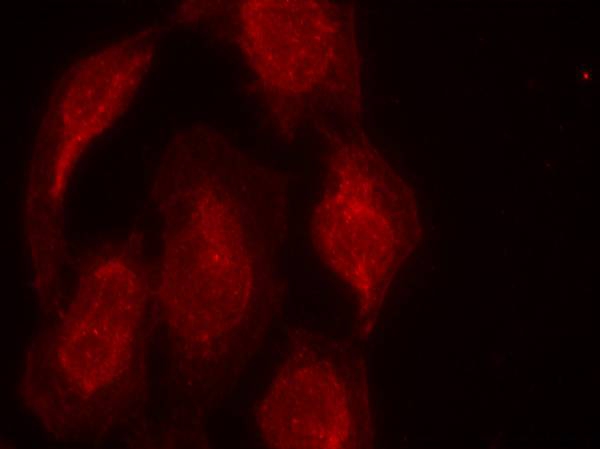 CDK6(Ab-13) Antibody