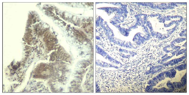 CDK6(Ab-13) Antibody