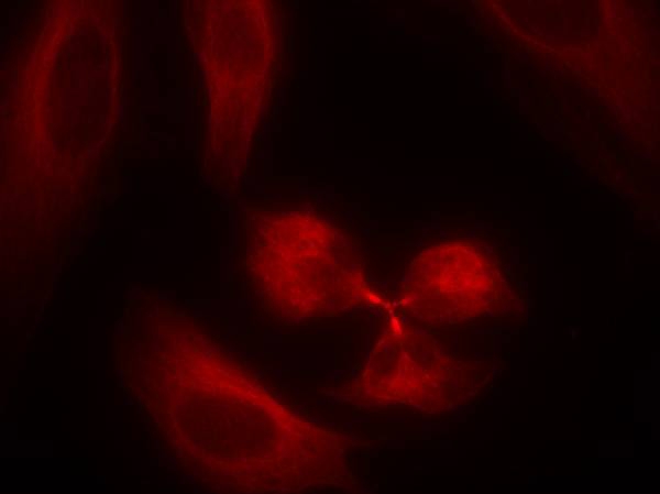 syk(Ab-323) Antibody