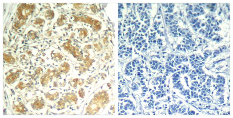 syk(Ab-323) Antibody