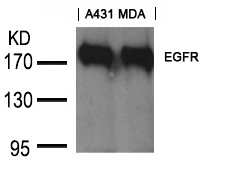 EGFR(Ab-1197) Goat Polyclonal Antibody