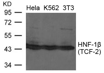 HNF-1b(TCF-2) Antibody