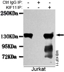 KIF11 Monoclonal Antibody