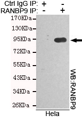 RANBP9 Monoclonal Antibody