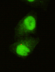 JARID1C Monoclonal Antibody