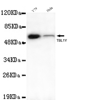 TBL1Y Monoclonal Antibody