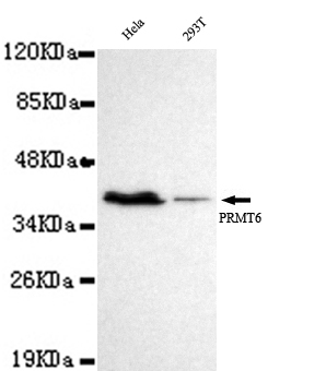 PRMT6 Monoclonal Antibody