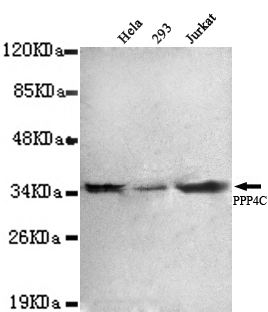 Protein Phosphatase 4C Monoclonal Antibody