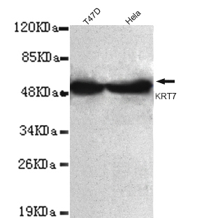 Keratin 7(C-term) Monoclonal Antibody