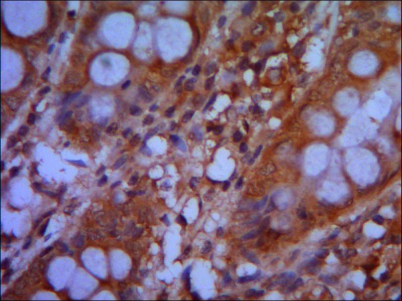 CHD3 Monoclonal Antibody