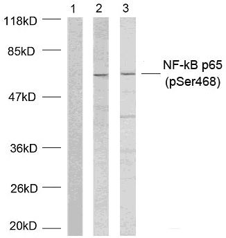 NFκB-p65(Phospho-Ser468) Antibody