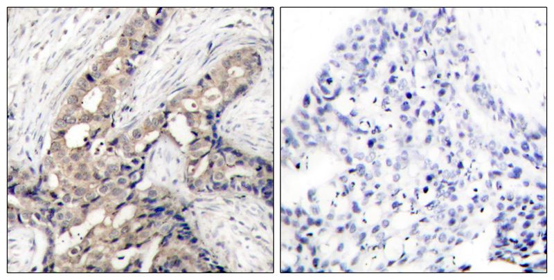 c-Abl(Phospho-Tyr412) Antibody