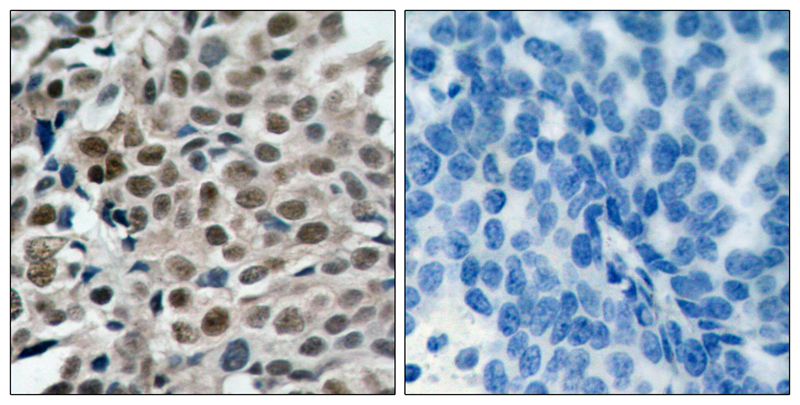 FKHRL1(Phospho-Ser253) Antibody