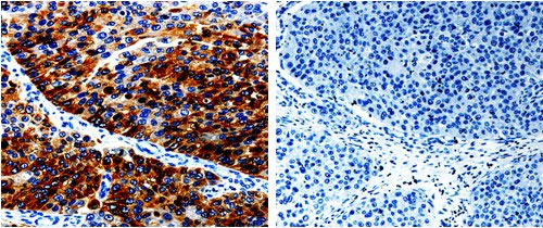 AGR2 Antibody