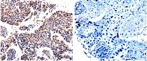 AKR1B1 Antibody