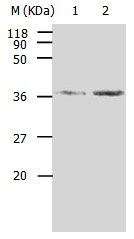 AKR1B1 Antibody