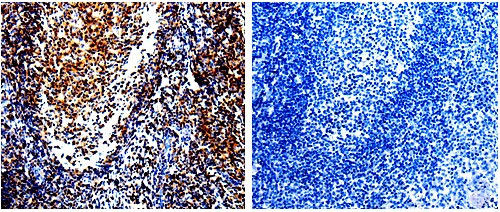 CDKN1A Antibody