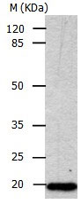 CDKN1A Antibody