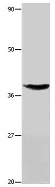 TNFRSF6 Antibody